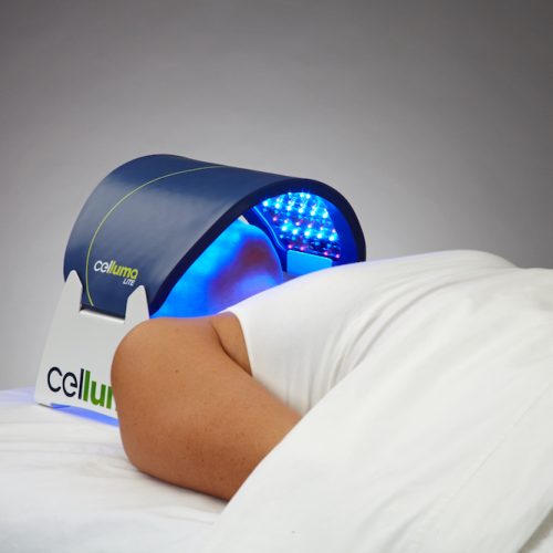 Celluma Light Therapy for Acne, Inflammation & Muscle & Joint Pain Treatment