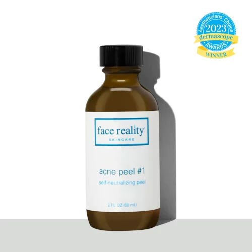 Face Reality Acne Chemical Peel
